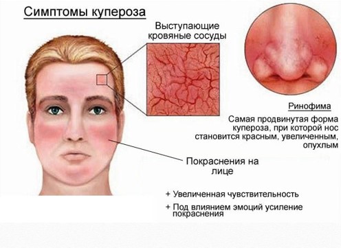 Симптомы купероза